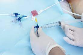 blocked catheter