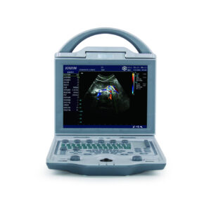 metal privacy screen panels