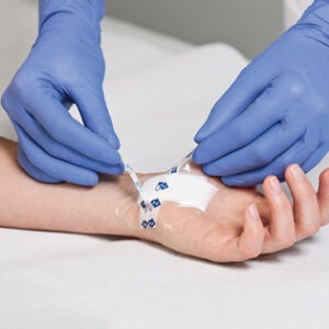 Hydrofilm Plus Transparent Film Dressing with Absorbent Pad